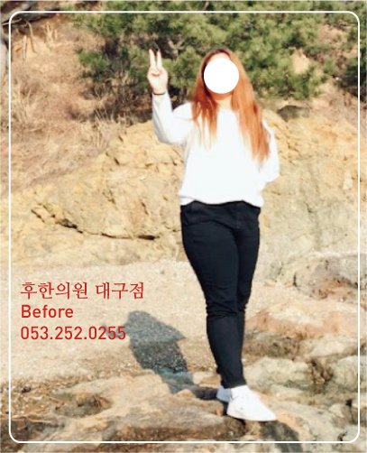 전후사진