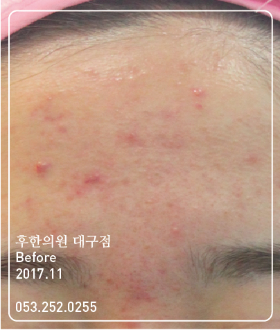 전후사진