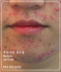 전후사진
