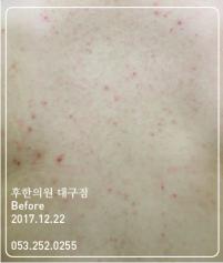 전후사진