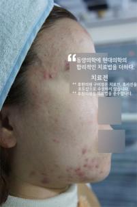 전후사진