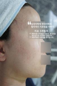 전후사진