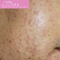 전후사진