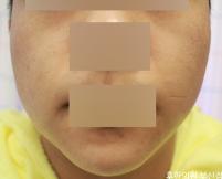 전후사진