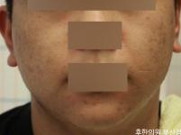 전후사진