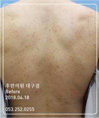 전후사진
