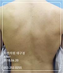 전후사진