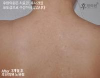 전후사진