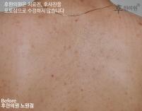 전후사진