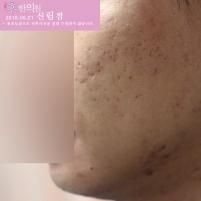 전후사진