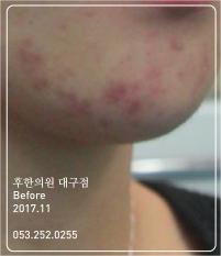 전후사진
