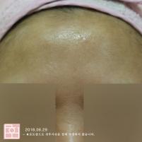 전후사진