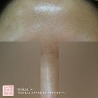 전후사진