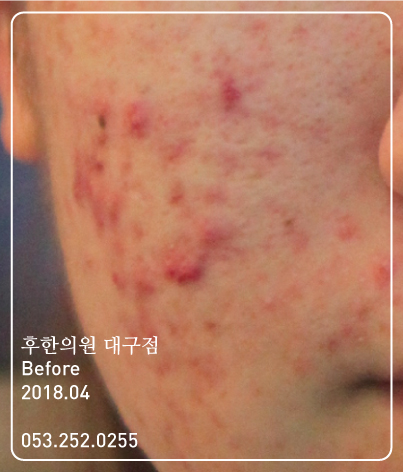 전후사진