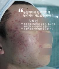 전후사진