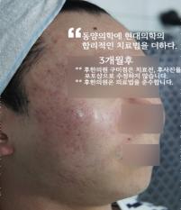 전후사진
