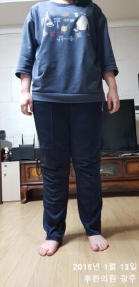 전후사진