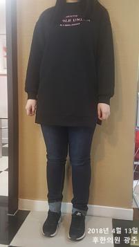 전후사진
