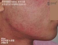 전후사진