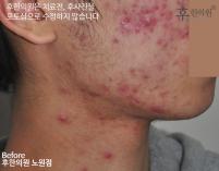 전후사진