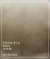 전후사진