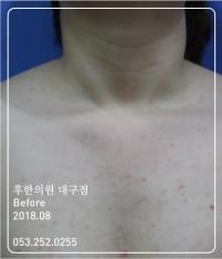 전후사진