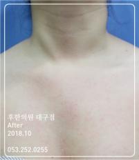전후사진