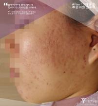 전후사진