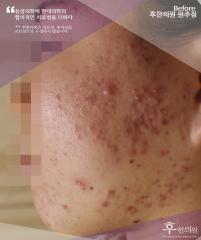 전후사진