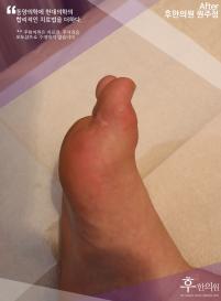 전후사진