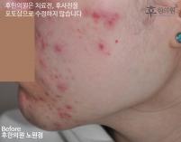 전후사진