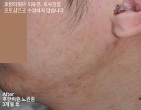 전후사진