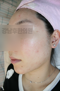 전후사진