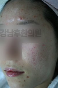 전후사진