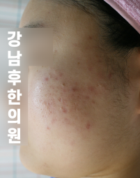 전후사진