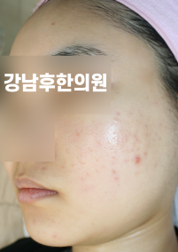 전후사진