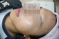 전후사진
