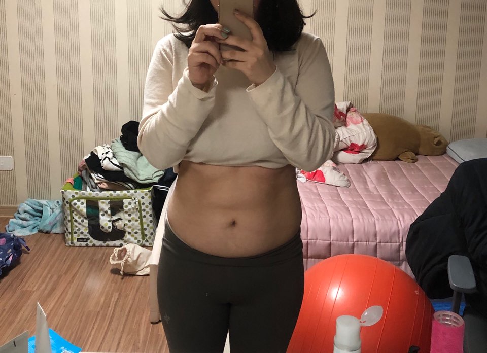 전후사진