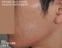 전후사진