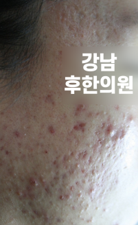 전후사진