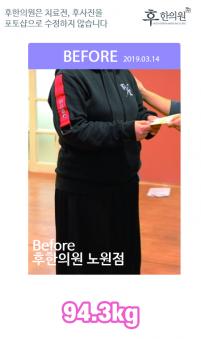 치료 전