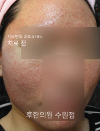 전후사진