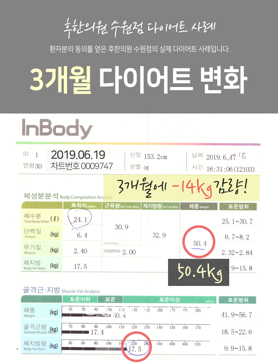 치료 후