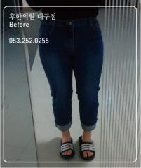 치료 전