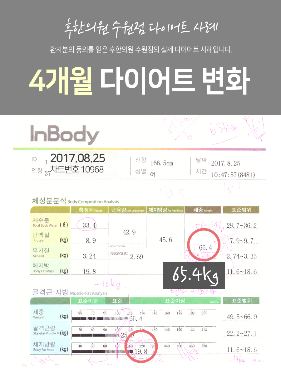 치료 전