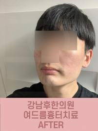 전후사진