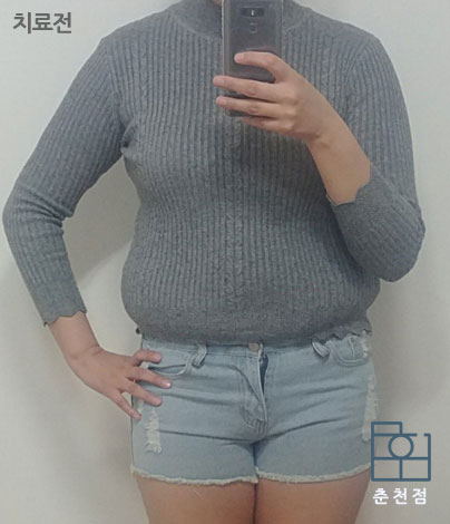 전후사진