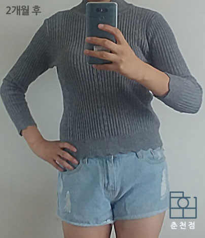 전후사진