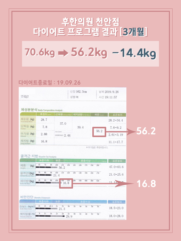 전후사진