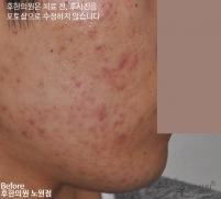 전후사진